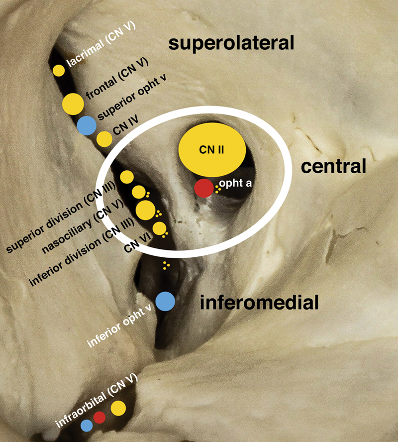 Anatomical dissection showing the superior orbital fissure compartments with cranial nerves and vessels