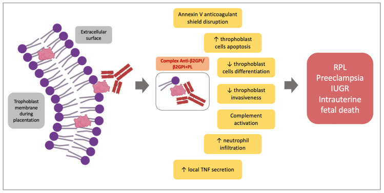 Obstetric antiphospholipid syndrome mechanisms showing trophoblast invasion impairment, NETosis, and extracellular vesicles in placental dysfunction