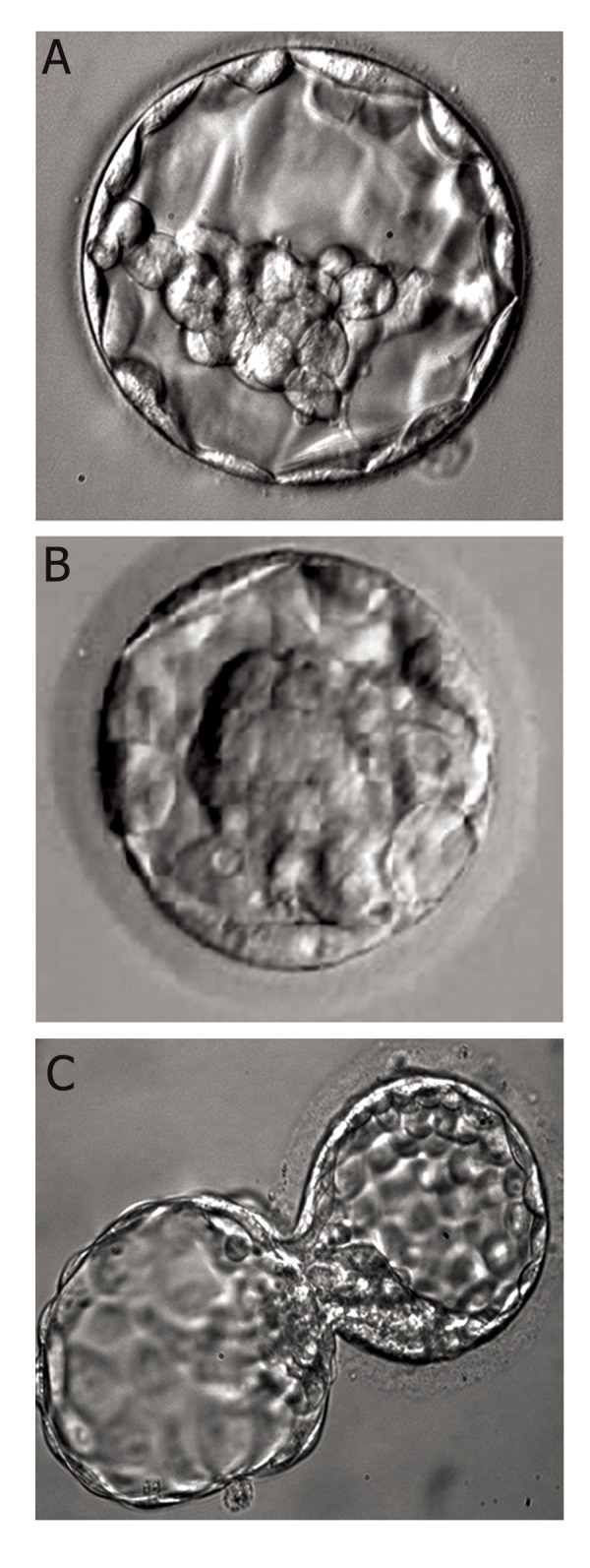 Blastocyst grading system showing expansion grades 1-6 and ICM/TE grades A, B, C with representative photomicrographs