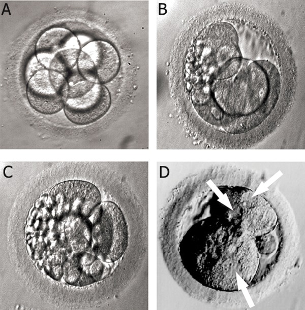 Day 2 to day 3 cleavage stage embryo development showing cell division progression and quality grading