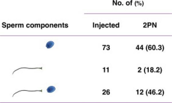 ICSI intracytoplasmic sperm injection showing holding pipette stabilizing oocyte and injection pipette delivering single sperm into cytoplasm