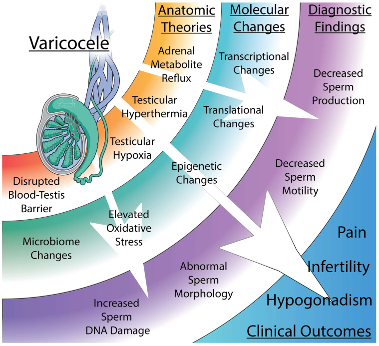 Varicocele pathophysiology showing molecular mechanisms including oxidative stress, DNA fragmentation, and hormonal disruption