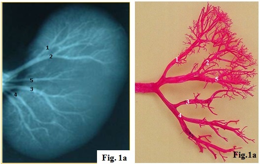 Renal artery segmental branches showing apical, upper, middle, lower, and posterior segments