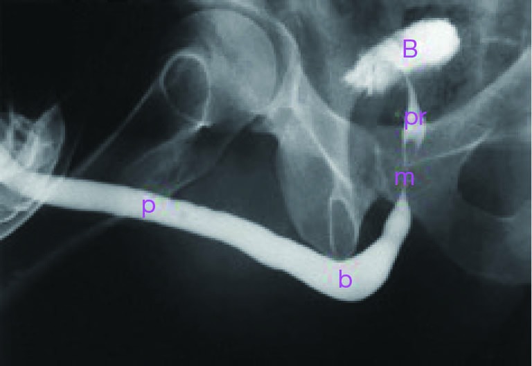 Normal retrograde urethrogram demonstrating male urethral anatomy and segments