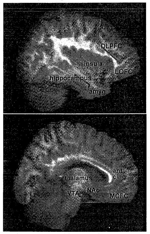Key brain regions involved in addiction pathology