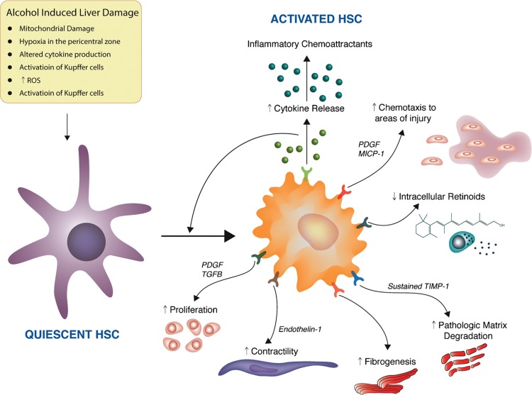 Hepatic stellate cell activation in alcoholic liver fibrosis