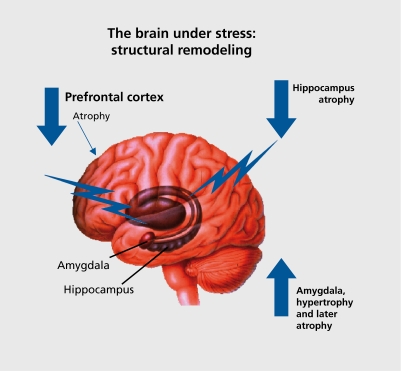 Diagram mapping brain regions involved in stress perception and response including hippocampus, amygdala, and prefrontal cortex that undergo structural remodeling under chronic stress