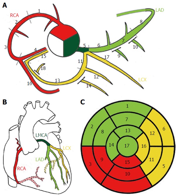 Schematic diagram of normal coronary artery anatomy showing the left main, LAD, LCx, and RCA with their major branches