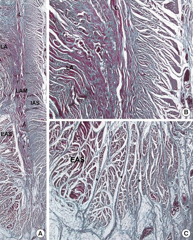 Coronal section of the anal canal showing the internal and external anal sphincters, longitudinal muscle, and surrounding structures
