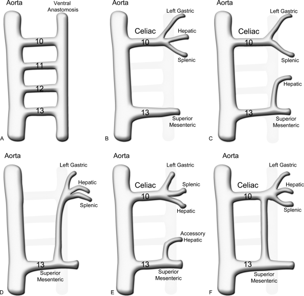 SMA arteriogram showing the superior mesenteric artery and its branches supplying the right colon
