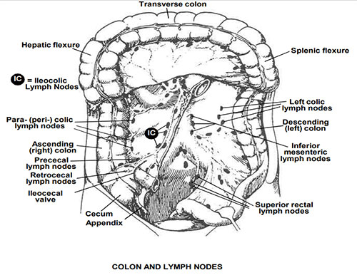 Diagram showing the colon with regional lymph node drainage pathways relevant to colorectal cancer staging and surgical resection