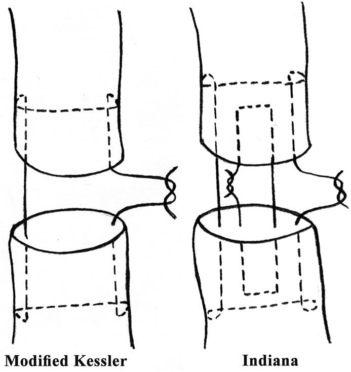 Flexor tendon repair suture techniques including two-strand and four-strand core suture methods