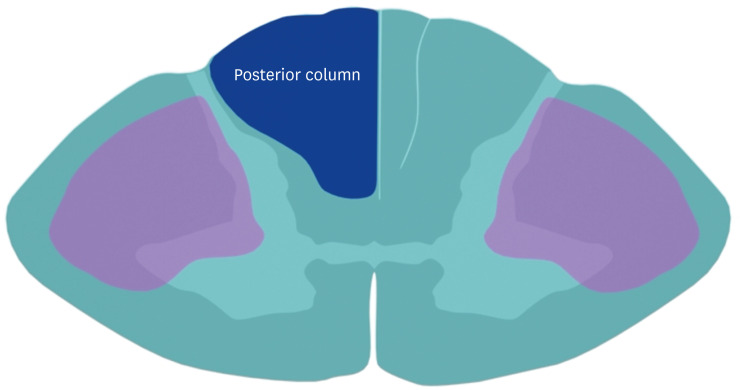 Diagram of the posterior column-medial lemniscus pathway for proprioception and fine touch