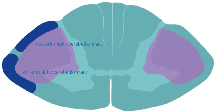 Diagram showing the posterior and anterior spinocerebellar tracts carrying unconscious proprioception
