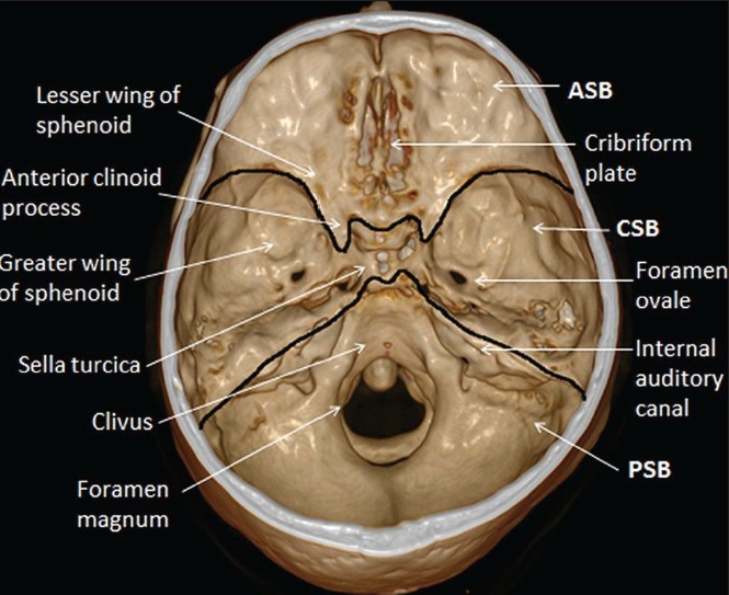 Endocranial view of the skull base showing the anterior, middle, and posterior cranial fossae with labeled anatomical landmarks