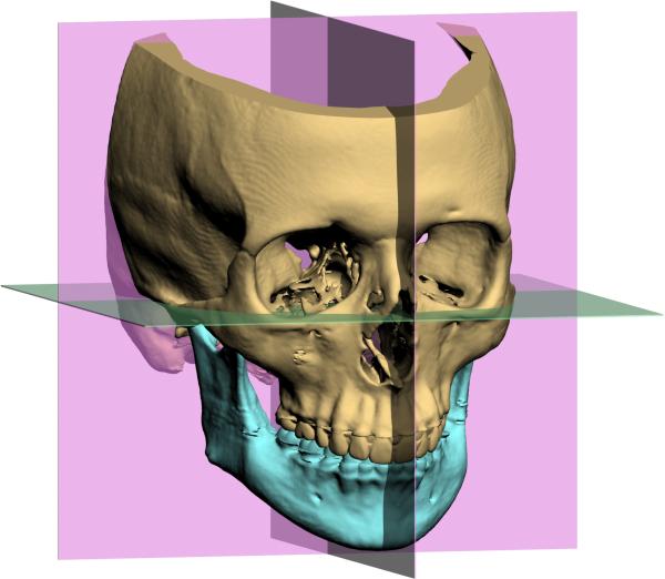 Three-dimensional external reference system showing orthogonal midsagittal, coronal, and axial planes for craniofacial analysis
