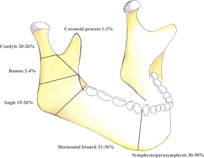 Anatomic diagram showing the regions of the mandible including symphysis, parasymphysis, body, angle, ramus, coronoid, and condyle