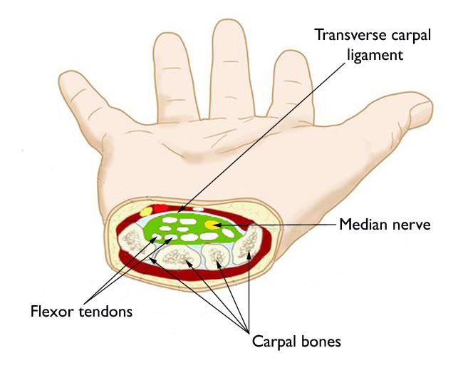 Cross-sectional anatomy of the carpal tunnel showing the median nerve, flexor tendons, and transverse carpal ligament
