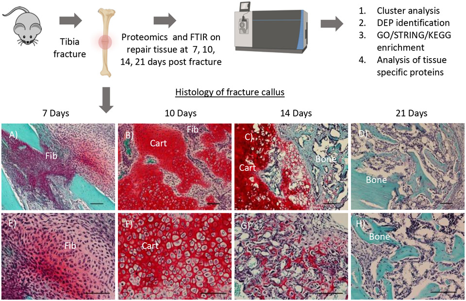 Fracture callus histology at days 7, 10, 14, and 21 post-injury showing progression from fibrous tissue through cartilage to mineralized bone