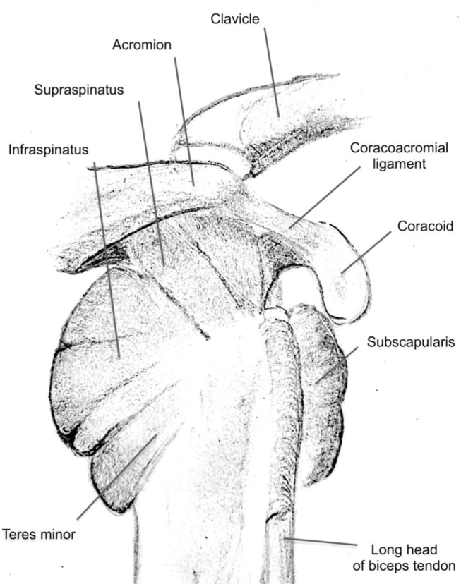 Anatomical diagram showing the insertions of the four rotator cuff tendons on the proximal humerus including supraspinatus, infraspinatus, teres minor, and subscapularis