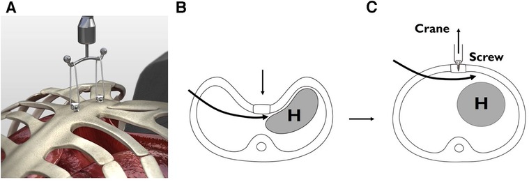 Diagram illustrating pediatric trauma assessment approach and anatomical differences from adult trauma patients