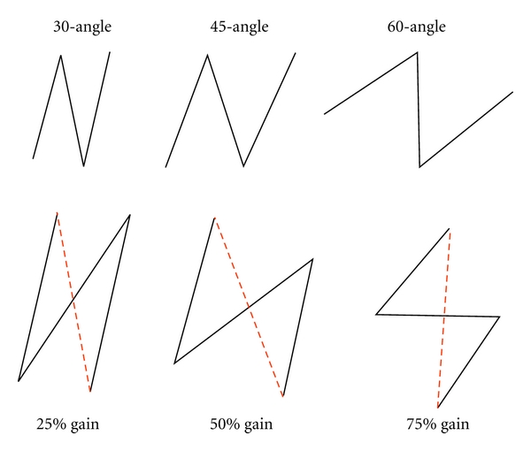 Diagram comparing Z-plasty angle variations from 30 to 90 degrees showing different length gains and transposition