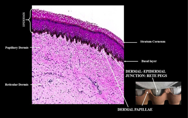 Diagram showing extracellular matrix components of the dermis including collagen fibrils, elastin, and ground substance