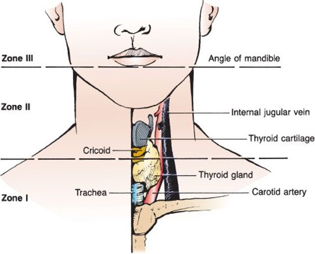 Neck zones I II III anatomy trauma surgery diagram