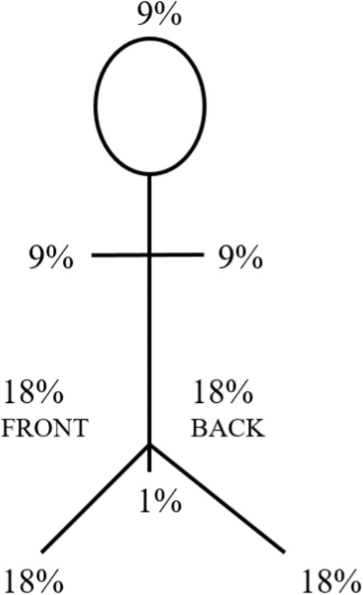 Rule of Nines diagram showing body surface area percentages for burn estimation in adults