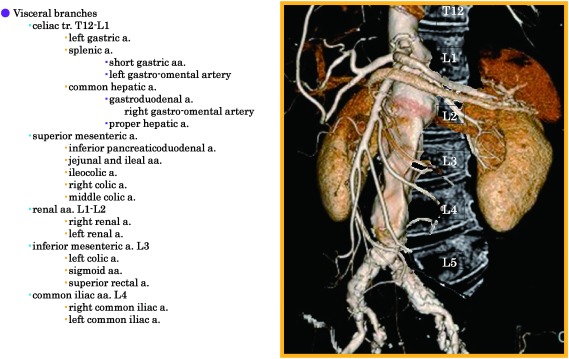 Visceral branches of the abdominal aorta including celiac trunk, SMA, renal arteries, and IMA