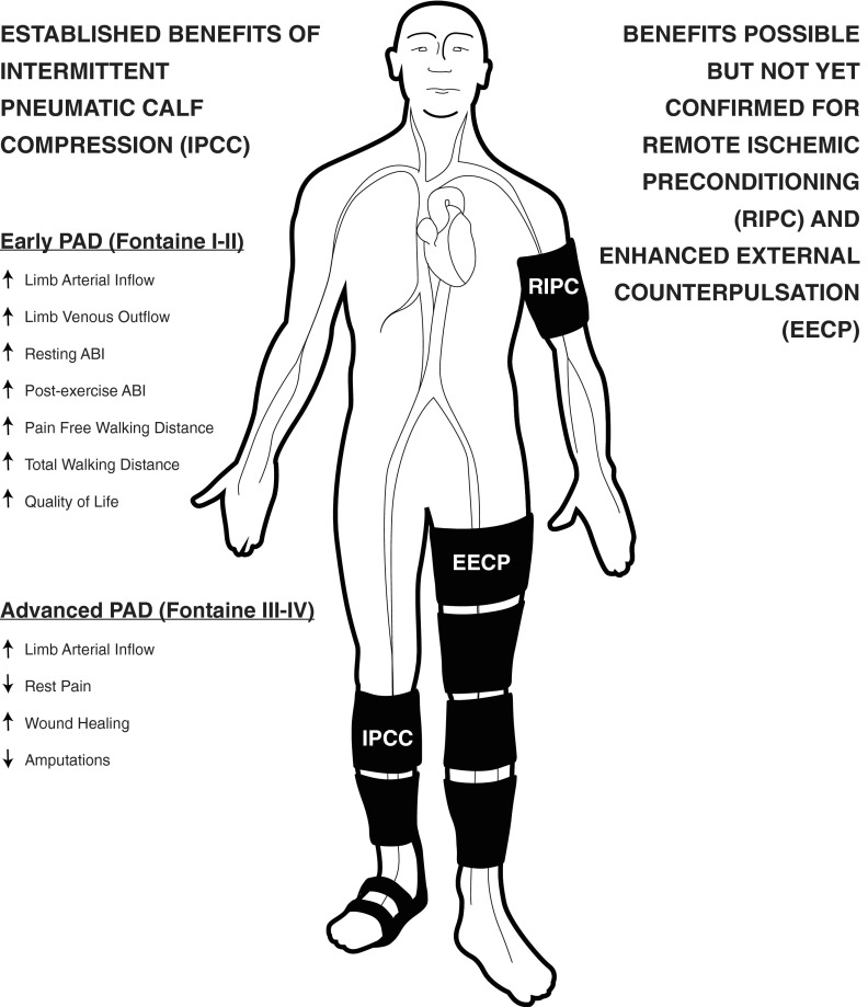 Diagram showing physiological basis of mechanical therapies for PAD including intermittent pneumatic compression and remote ischemic preconditioning